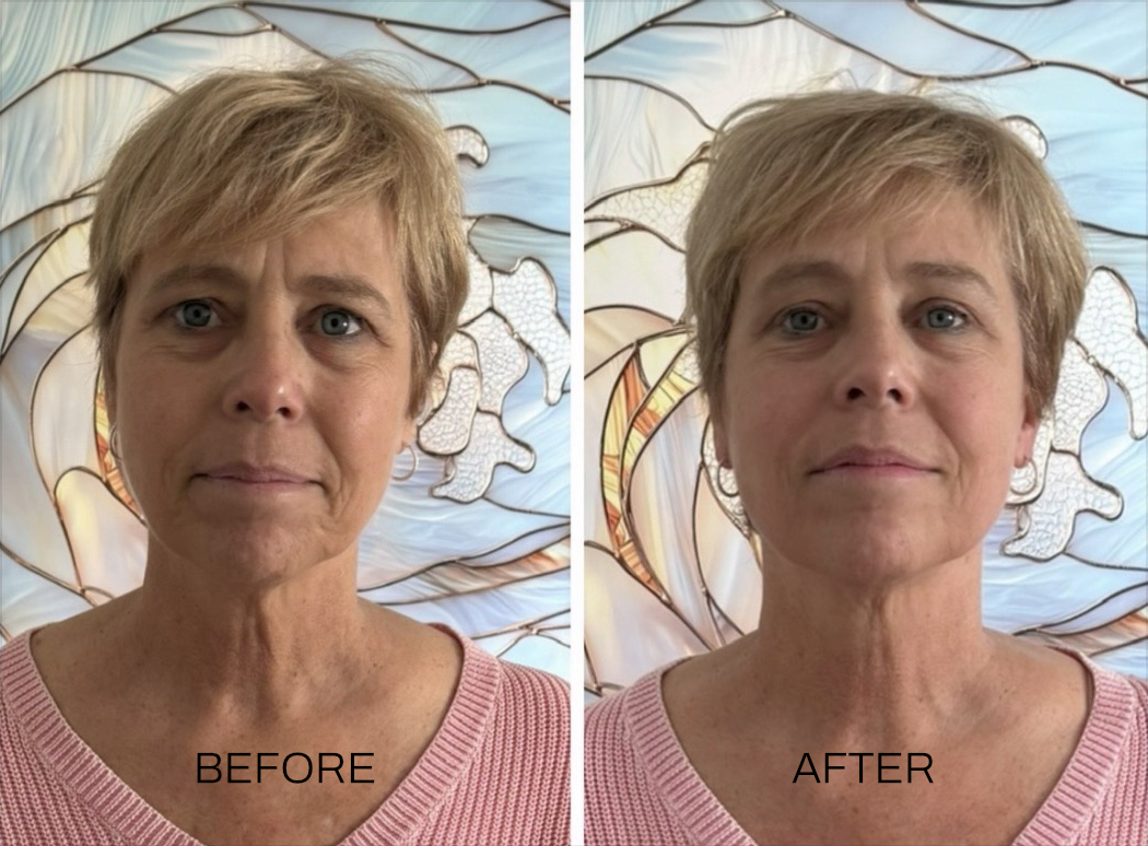 Before and after comparison of a buccal massage client, labeled before on the left and after on the right